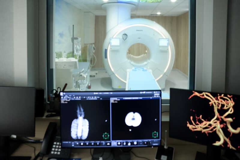 Nowoczesna diagnostyka dla pacjentów Szpitala Praskiego