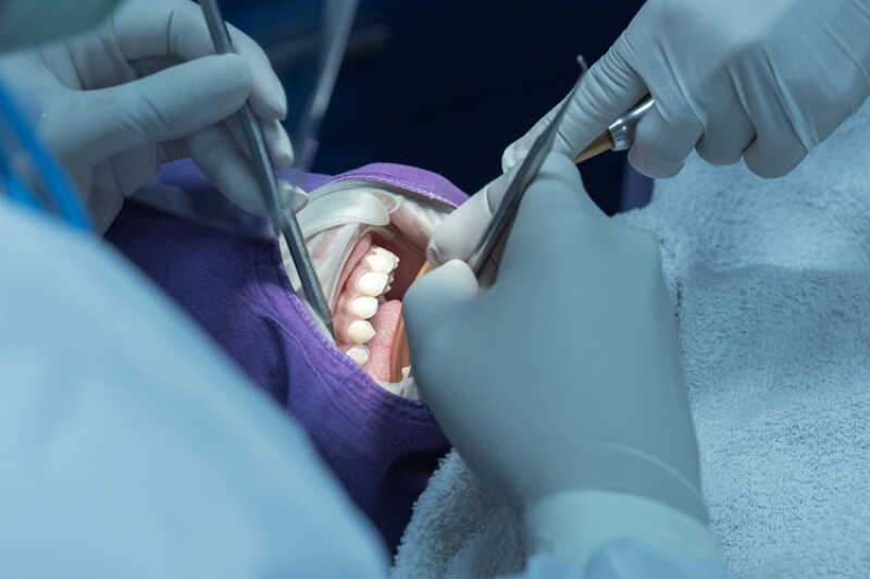 Opracowanie kanału zęba krok po kroku - jak wygląda zabieg w DenticaNova?